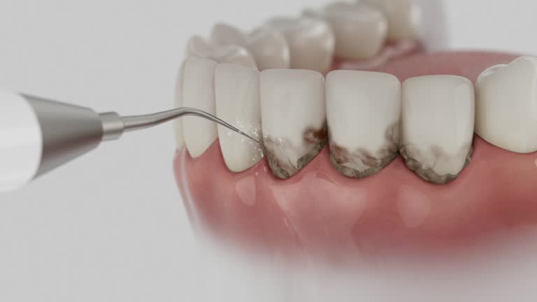 Reliable Dental contractor in Bar Nunn, WY by Dentist Open Now